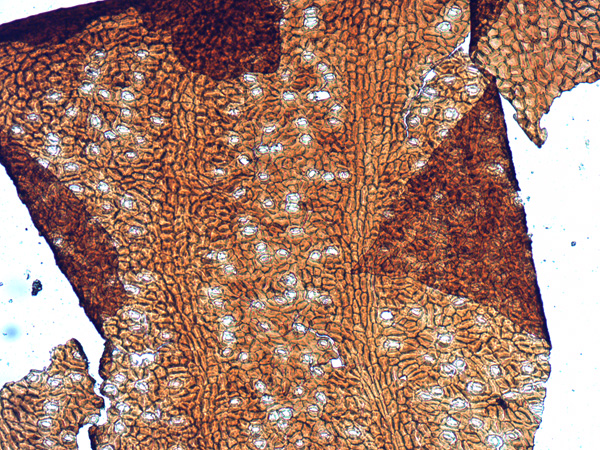 Brown tissue at high magnification. Its cells form a regular pattern with light spots of stomata