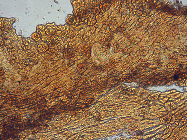 Brown tissue at high magnification. Its cells form elongated patterns speckled with round stomata