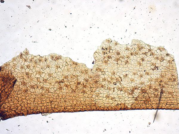 Brown tissue at high magnification. Its cells, alternating between lighter and darker, create a spotted pattern