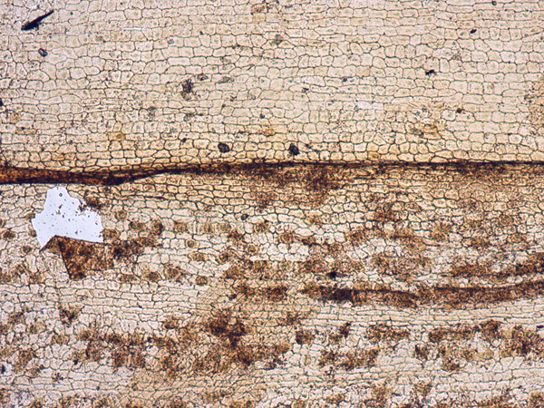 Brown tissue at high magnification. Its cells, alternately lighter and darker, create a mottled pattern