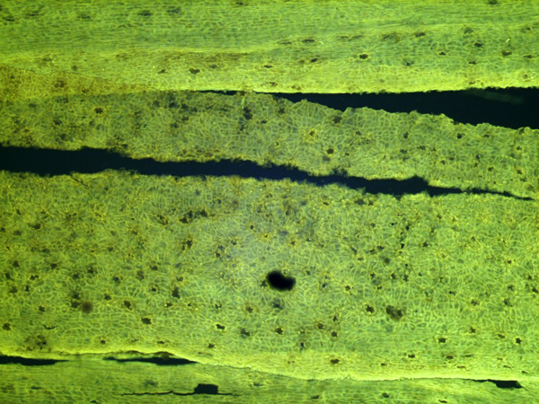 Green fluorescent plant tissue magnified against a black background, showing cell patterns